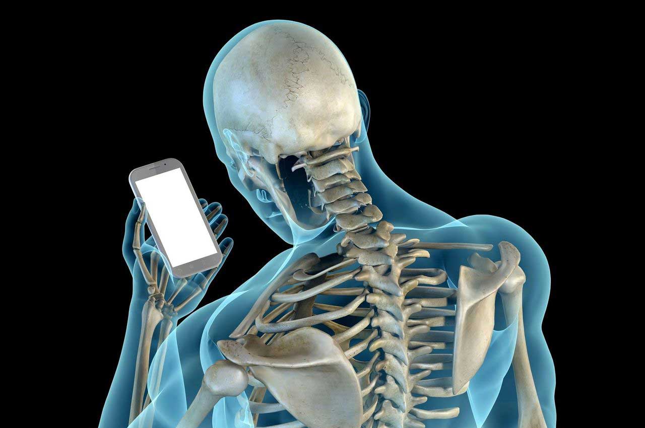 bad posture example