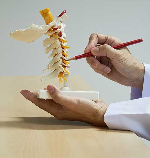 Cervical spine model