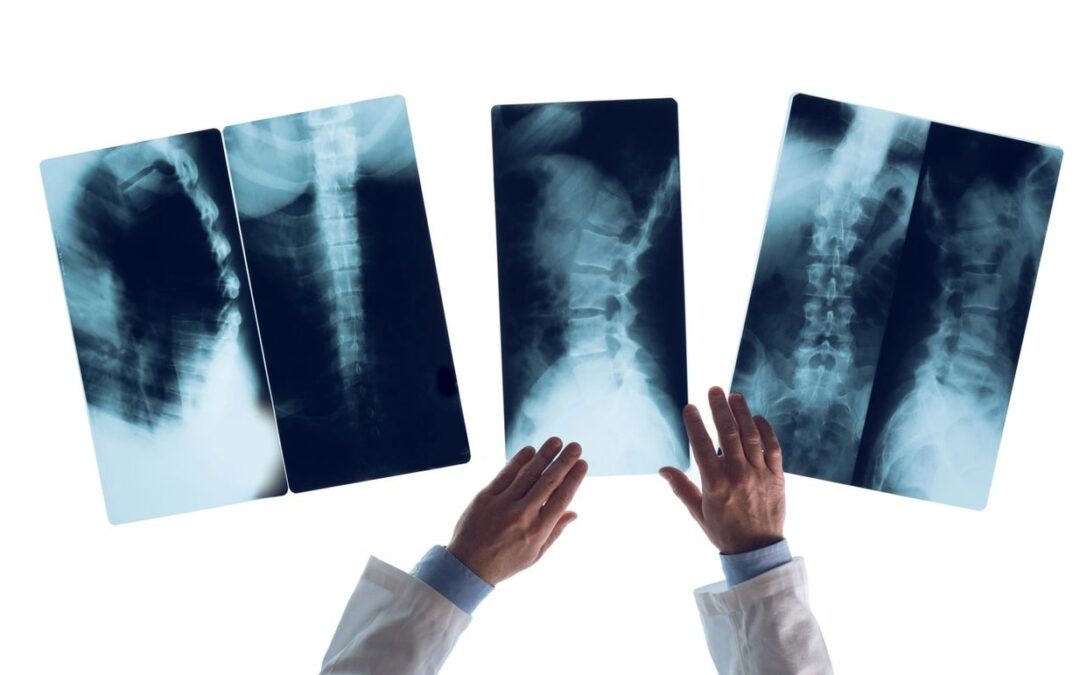 Why X-Rays Matter in Specific Chiropractic Care