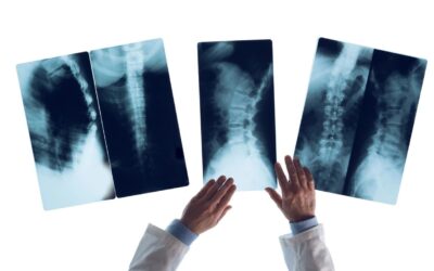 Why X-Rays Matter in Specific Chiropractic Care
