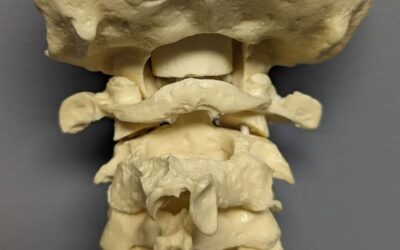 Visiting a chiropractor, here are things to watch for, like…
