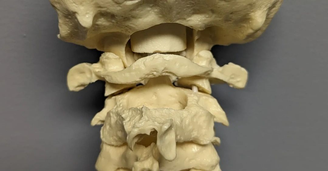 Visiting a chiropractor, here are things to watch for, like…